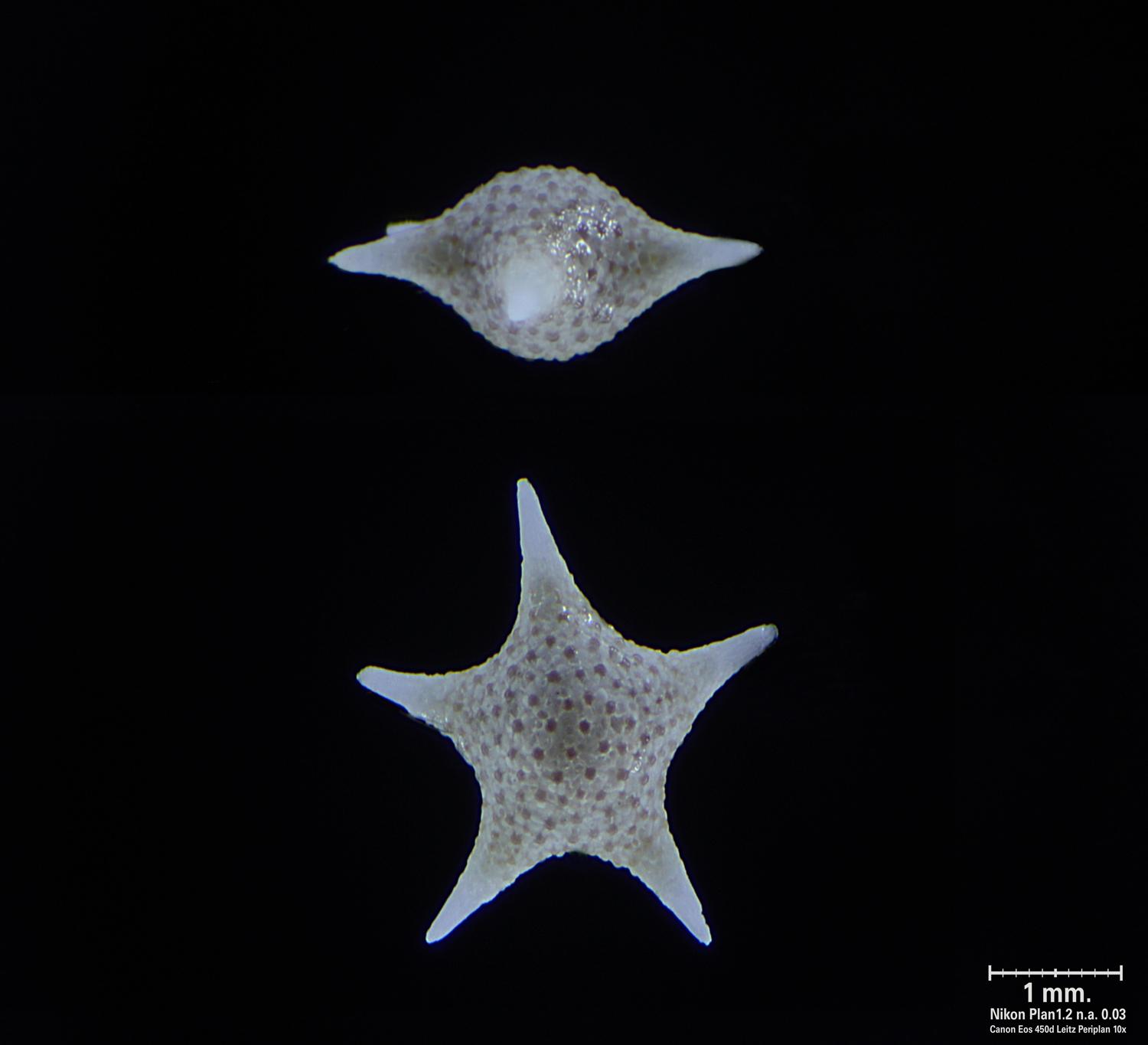 Baculogypsina sphaerulata - vista frontale e laterale